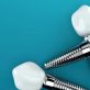 What To Expect With Dental Implants